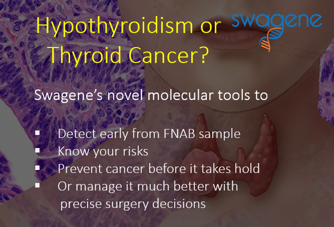 Swagene Hypothyroidism Thyroiditis Prevent Thyroid Cancer